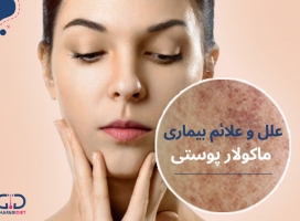 بیماری ماکولار یا آمیلوئیدوز پوستی چیست و چه درمانی دارد؟